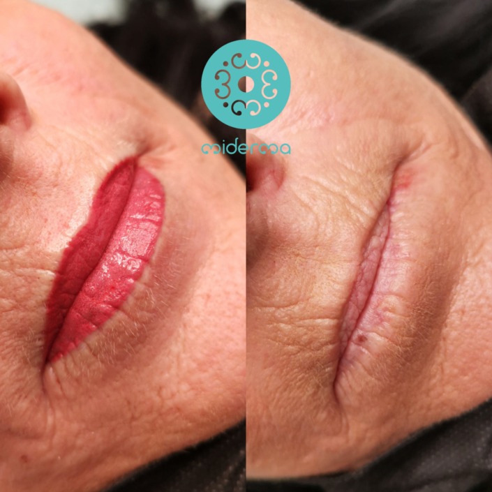 Anti-Aging Lippen Permanent Make-up Anti-Aging Lippen Permanent Make-up