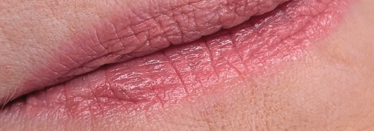 Lippen-PMU mit 65: so sieht es nach 5 Jahren aus