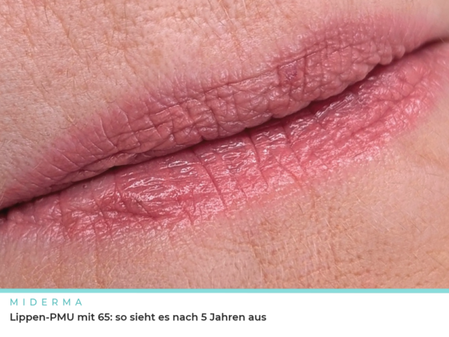 Lippen-PMU nach 5 Jahren: So sieht es aus und so wirkt eine Auffrischung