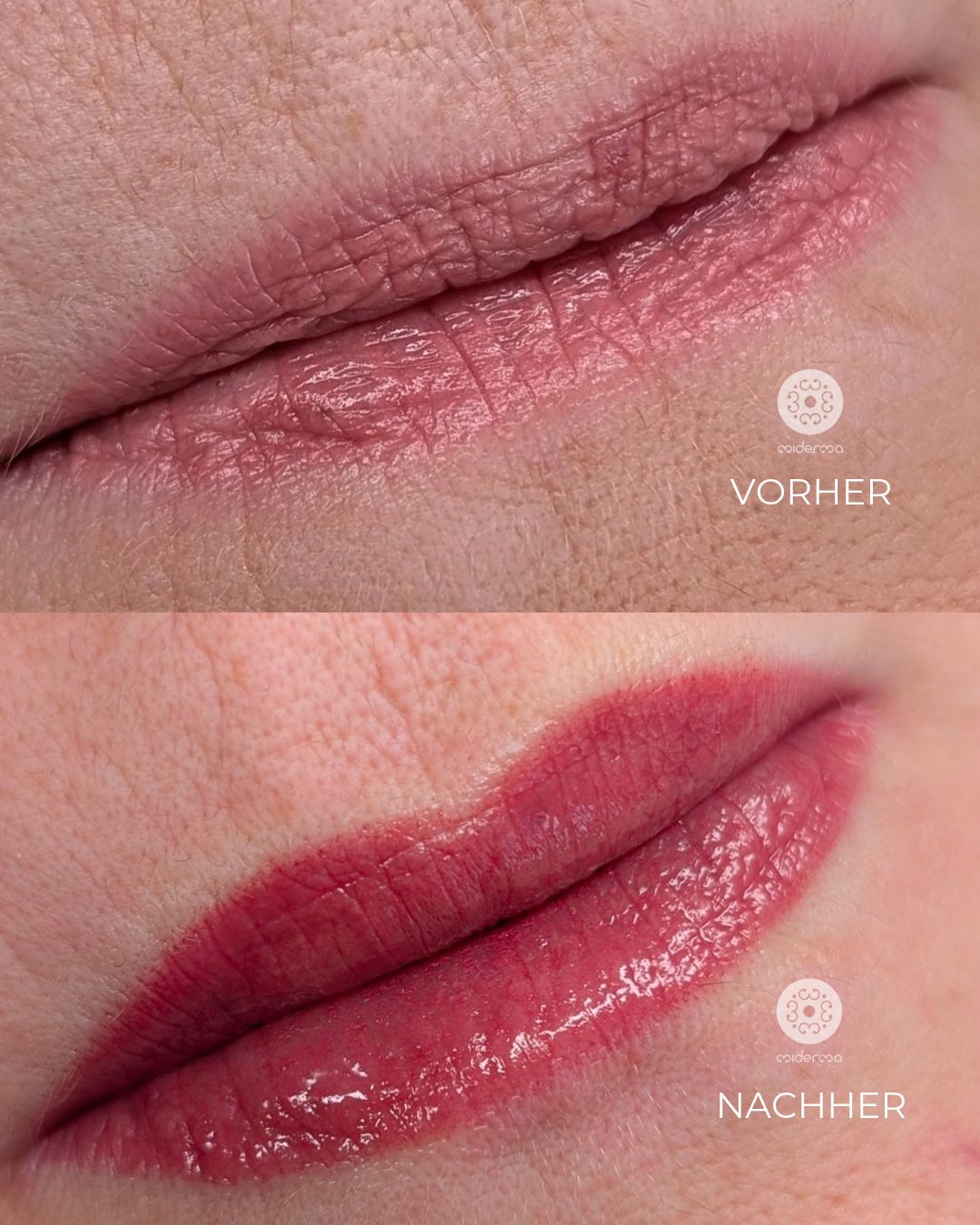 Lippen PMU vorher nachher: Auffrischung nach 5 Jahren Tragedauer