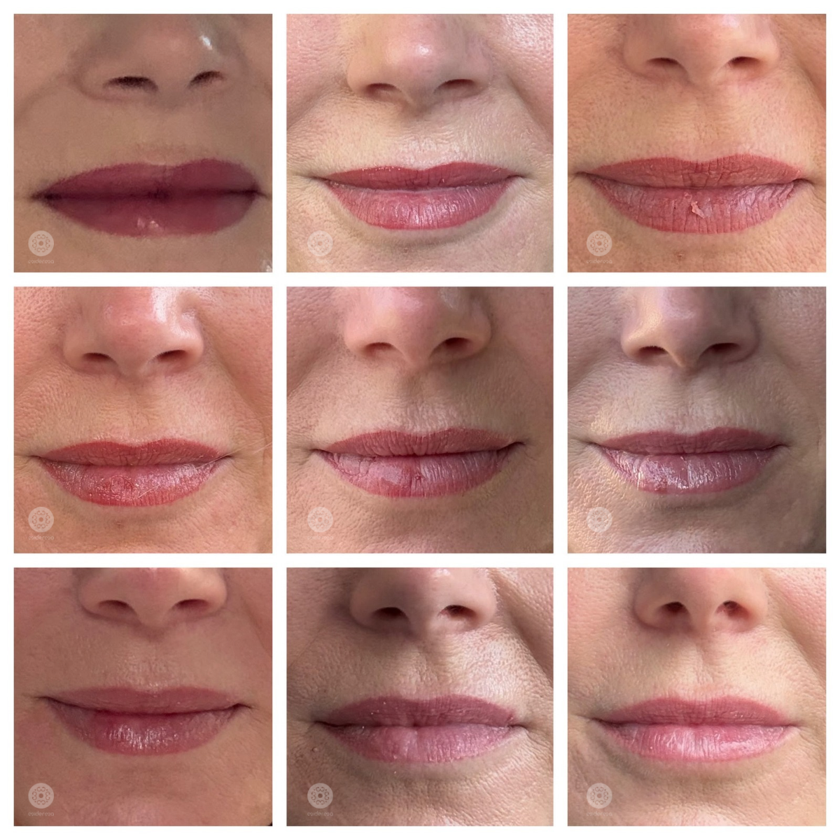 Lippen PMU Heilung in Bildern: Verlauf von direkt nach der Behandlung über die ersten Tage bis in die folgenden Wochen