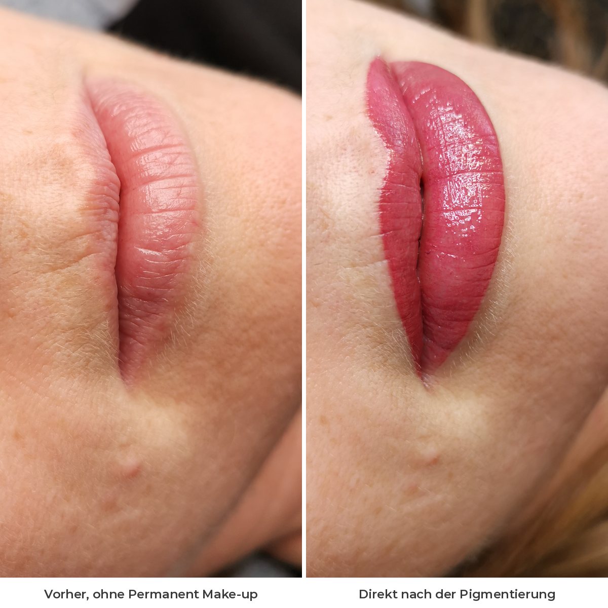Lippen vor der Lippenpigmentierung und direkt danach im Vergleich