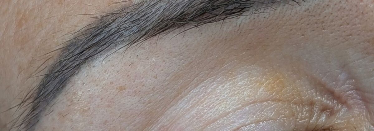 Augenbraue mit grau gewordenem Permanent Make-up, Ausgangslage für die Farbkorrektur bei Miderma