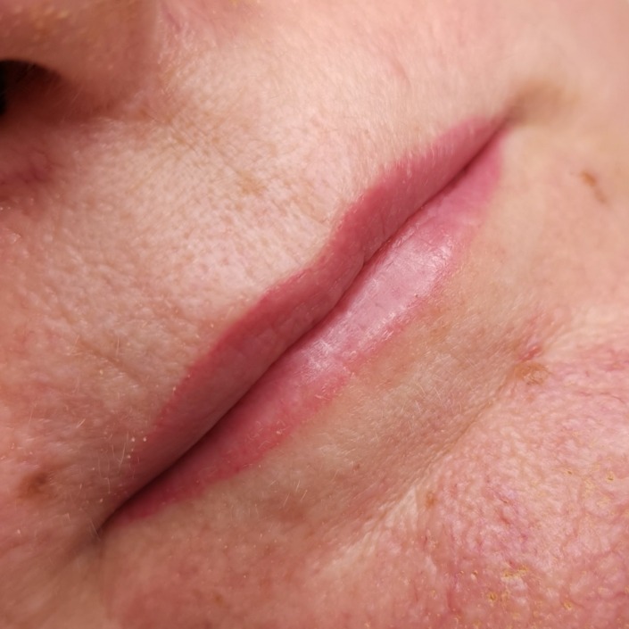 Lippe abgeheilt natürlich